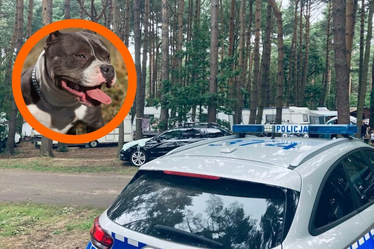 Karwieńskie Błota: pies rzucił się na rodzinę. Matka osłaniała swoje dzieci