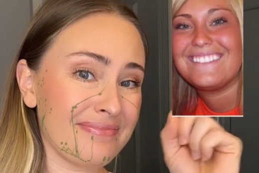 kortyzolowa twarz cortisol face moon face tiktok filmiki lekarze jak zmniejszyć poziom kortyzolu