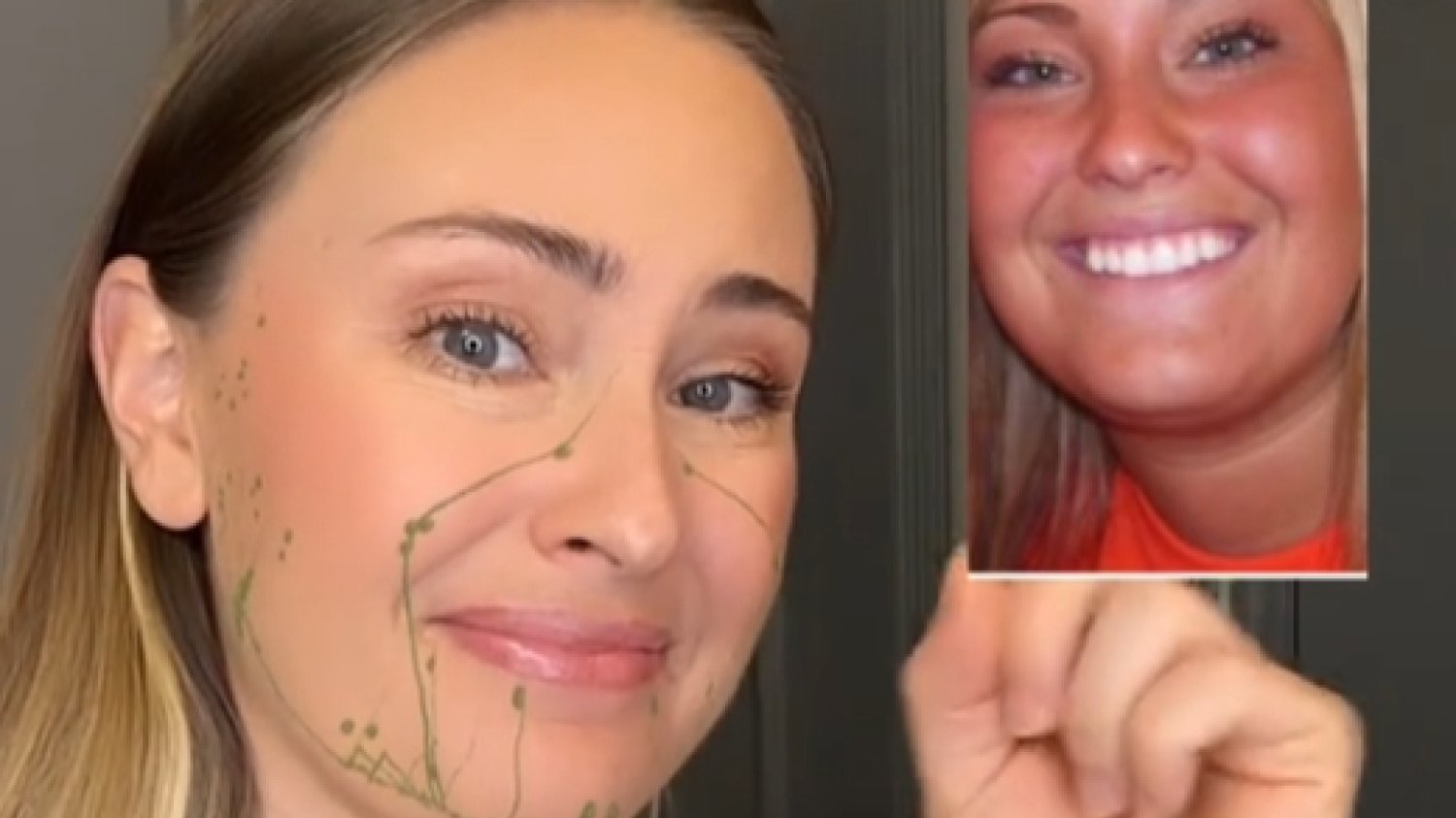 kortyzolowa twarz cortisol face moon face tiktok filmiki lekarze jak zmniejszyć poziom kortyzolu