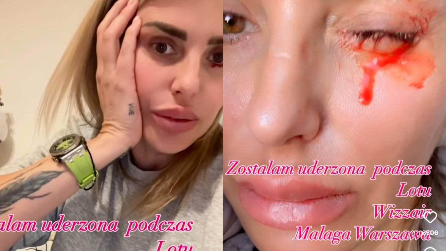 Przykry incydent z udziałem Moniki Goździalskiej. Została uderzona