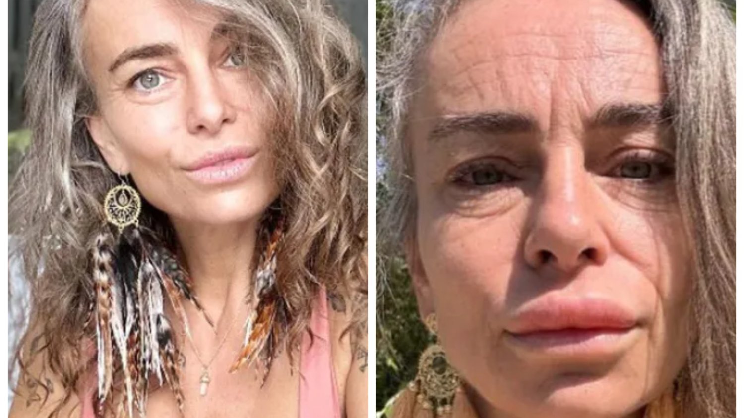 Kasia Nast wstrzyknęła sobie jad żaby. Jej twarz zdradza prawdę