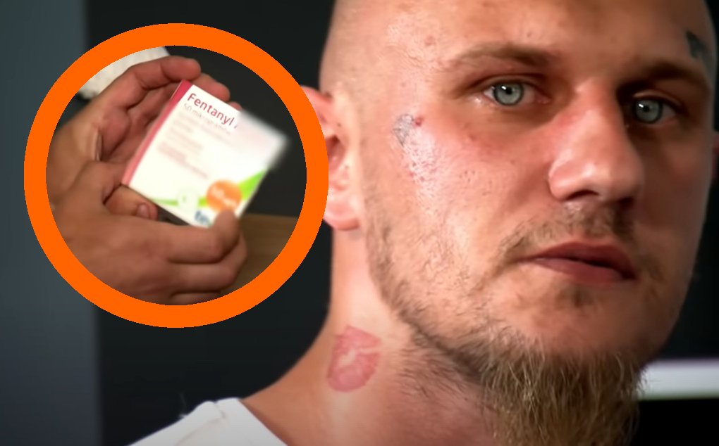 fentanyl narkotyk zombie lek przeciwbólowy historia mateusz żuromin uwaga tvn