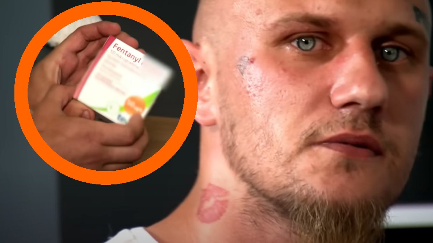fentanyl narkotyk zombie lek przeciwbólowy historia mateusz żuromin uwaga tvn