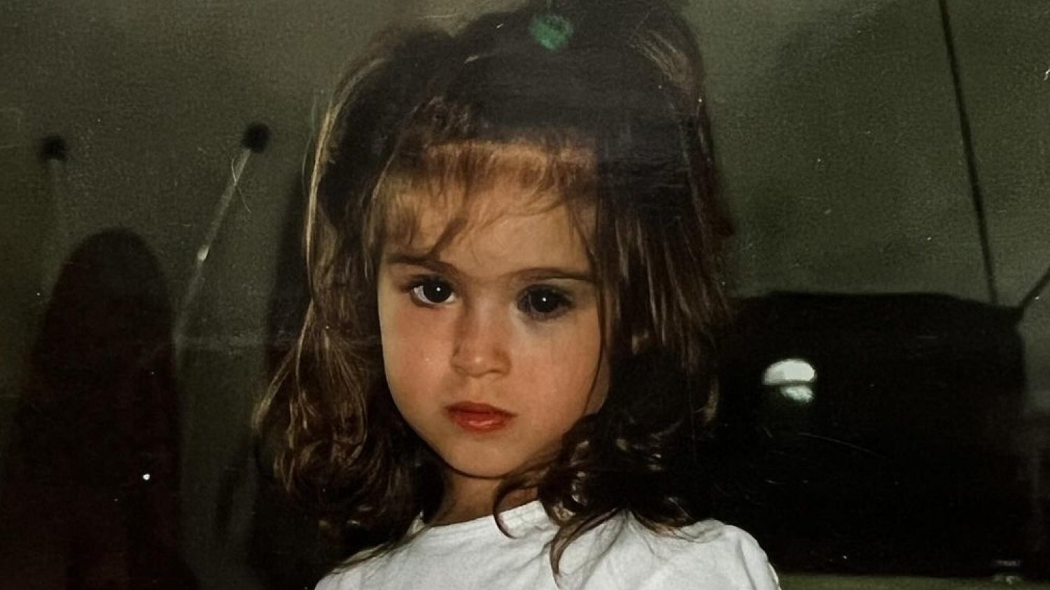 Carlotta Bertotti znamię oty niebieskie znamię na półtwarzy co to jest modelka influencerka Carlotta Bertotti znamię oty niebieskie znamię na półtwarzy co to jest modelka influencerka